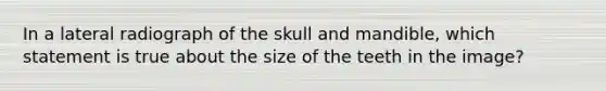 In a lateral radiograph of the skull and mandible, which statement is true about the size of the teeth in the image?