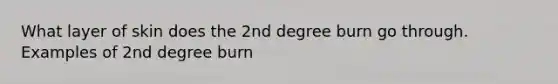 What layer of skin does the 2nd degree burn go through. Examples of 2nd degree burn