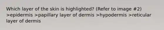 Which layer of the skin is highlighted? (Refer to image #2) >epidermis >papillary layer of dermis >hypodermis >reticular layer of dermis