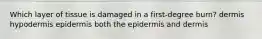 Which layer of tissue is damaged in a first-degree burn? dermis hypodermis epidermis both the epidermis and dermis