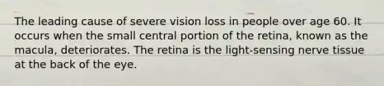 The leading cause of severe vision loss in people over age 60. It occurs when the small central portion of the retina, known as the macula, deteriorates. The retina is the light-sensing nerve tissue at the back of the eye.