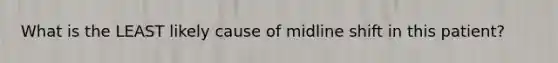 What is the LEAST likely cause of midline shift in this patient?