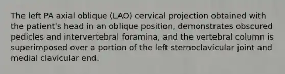 The left PA axial oblique (LAO) cervical projection obtained with the patient's head in an oblique position, demonstrates obscured pedicles and intervertebral foramina, and the vertebral column is superimposed over a portion of the left sternoclavicular joint and medial clavicular end.