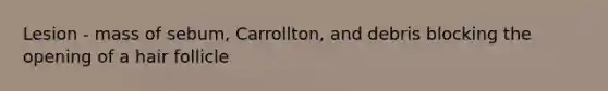 Lesion - mass of sebum, Carrollton, and debris blocking the opening of a hair follicle