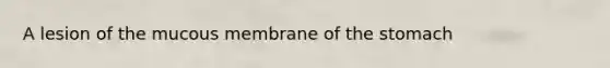 A lesion of the mucous membrane of <a href='https://www.questionai.com/knowledge/kLccSGjkt8-the-stomach' class='anchor-knowledge'>the stomach</a>