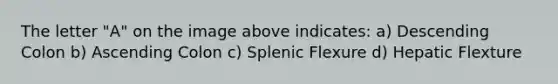 The letter "A" on the image above indicates: a) Descending Colon b) Ascending Colon c) Splenic Flexure d) Hepatic Flexture