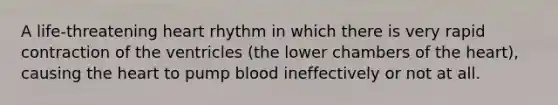 A life-threatening heart rhythm in which there is very rapid contraction of the ventricles (the lower chambers of the heart), causing the heart to pump blood ineffectively or not at all.