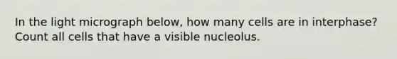 In the light micrograph below, how many cells are in interphase? Count all cells that have a visible nucleolus.