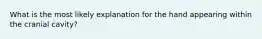 What is the most likely explanation for the hand appearing within the cranial cavity?