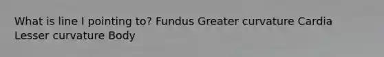 What is line I pointing to? Fundus Greater curvature Cardia Lesser curvature Body