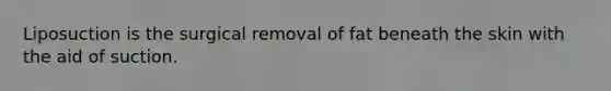 Liposuction is the surgical removal of fat beneath the skin with the aid of suction.