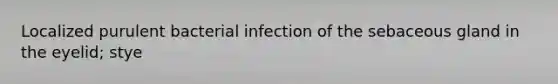 Localized purulent bacterial infection of the sebaceous gland in the eyelid; stye