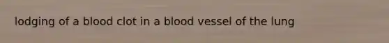 lodging of a blood clot in a blood vessel of the lung