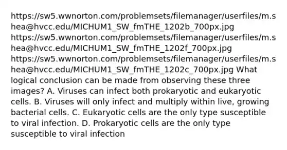 https://sw5.wwnorton.com/problemsets/filemanager/userfiles/m.shea@hvcc.edu/MICHUM1_SW_fmTHE_1202b_700px.jpg https://sw5.wwnorton.com/problemsets/filemanager/userfiles/m.shea@hvcc.edu/MICHUM1_SW_fmTHE_1202f_700px.jpg https://sw5.wwnorton.com/problemsets/filemanager/userfiles/m.shea@hvcc.edu/MICHUM1_SW_fmTHE_1202c_700px.jpg What logical conclusion can be made from observing these three images? A. Viruses can infect both prokaryotic and eukaryotic cells. B. Viruses will only infect and multiply within live, growing bacterial cells. C. Eukaryotic cells are the only type susceptible to viral infection. D. Prokaryotic cells are the only type susceptible to viral infection