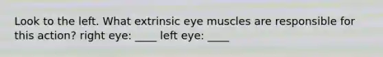 Look to the left. What extrinsic eye muscles are responsible for this action? right eye: ____ left eye: ____