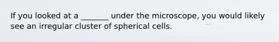 If you looked at a _______ under the microscope, you would likely see an irregular cluster of spherical cells.