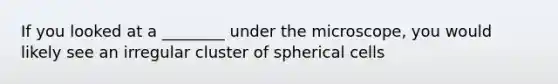 If you looked at a ________ under the microscope, you would likely see an irregular cluster of spherical cells