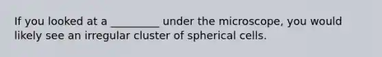 If you looked at a _________ under the microscope, you would likely see an irregular cluster of spherical cells.