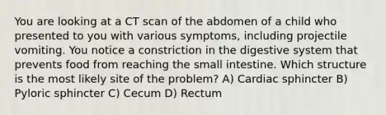 You are looking at a CT scan of the abdomen of a child who presented to you with various symptoms, including projectile vomiting. You notice a constriction in the digestive system that prevents food from reaching the small intestine. Which structure is the most likely site of the problem? A) Cardiac sphincter B) Pyloric sphincter C) Cecum D) Rectum