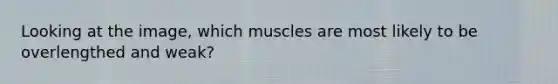 Looking at the image, which muscles are most likely to be overlengthed and weak?