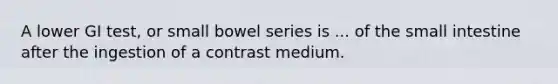 A lower GI test, or small bowel series is ... of the small intestine after the ingestion of a contrast medium.