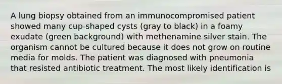 A lung biopsy obtained from an immunocompromised patient showed many cup-shaped cysts (gray to black) in a foamy exudate (green background) with methenamine silver stain. The organism cannot be cultured because it does not grow on routine media for molds. The patient was diagnosed with pneumonia that resisted antibiotic treatment. The most likely identification is
