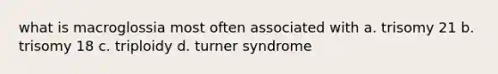 what is macroglossia most often associated with a. trisomy 21 b. trisomy 18 c. triploidy d. turner syndrome