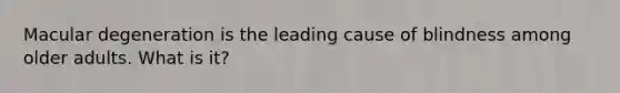 Macular degeneration is the leading cause of blindness among older adults. What is it?