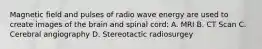 Magnetic field and pulses of radio wave energy are used to create images of the brain and spinal cord: A. MRI B. CT Scan C. Cerebral angiography D. Stereotactic radiosurgey