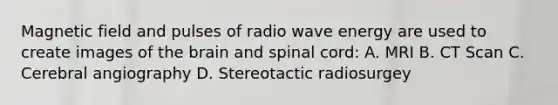 Magnetic field and pulses of radio wave energy are used to create images of <a href='https://www.questionai.com/knowledge/kLMtJeqKp6-the-brain' class='anchor-knowledge'>the brain</a> and spinal cord: A. MRI B. CT Scan C. Cerebral angiography D. Stereotactic radiosurgey