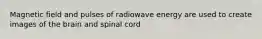 Magnetic field and pulses of radiowave energy are used to create images of the brain and spinal cord