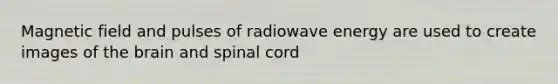 Magnetic field and pulses of radiowave energy are used to create images of the brain and spinal cord