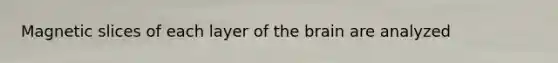 Magnetic slices of each layer of the brain are analyzed
