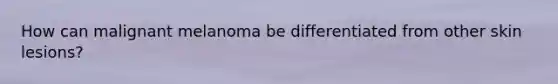 How can malignant melanoma be differentiated from other skin lesions?