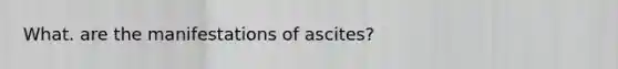 What. are the manifestations of ascites?