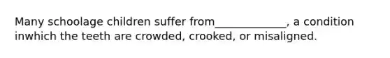 Many schoolage children suffer from_____________, a condition inwhich the teeth are crowded, crooked, or misaligned.