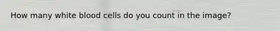 How many white blood cells do you count in the image?