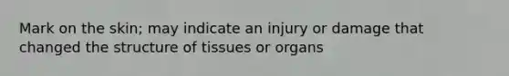 Mark on the skin; may indicate an injury or damage that changed the structure of tissues or organs