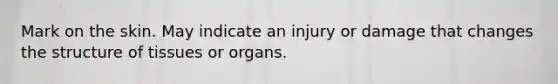 Mark on the skin. May indicate an injury or damage that changes the structure of tissues or organs.