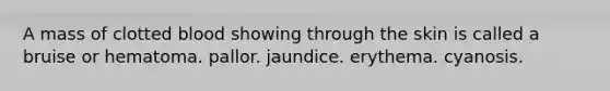 A mass of clotted blood showing through the skin is called a bruise or hematoma. pallor. jaundice. erythema. cyanosis.