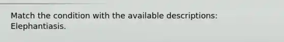 Match the condition with the available descriptions: Elephantiasis.