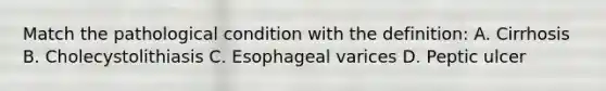 Match the pathological condition with the definition: A. Cirrhosis B. Cholecystolithiasis C. Esophageal varices D. Peptic ulcer