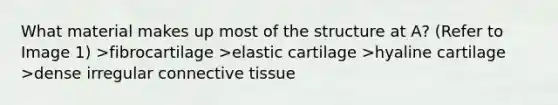 What material makes up most of the structure at A? (Refer to Image 1) >fibrocartilage >elastic cartilage >hyaline cartilage >dense irregular <a href='https://www.questionai.com/knowledge/kYDr0DHyc8-connective-tissue' class='anchor-knowledge'>connective tissue</a>