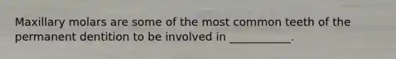 Maxillary molars are some of the most common teeth of the permanent dentition to be involved in ___________.