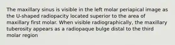 The maxillary sinus is visible in the left molar periapical image as the U-shaped radiopacity located superior to the area of maxillary first molar. When visible radiographically, the maxillary tuberosity appears as a radiopaque bulge distal to the third molar region