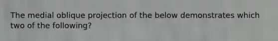 The medial oblique projection of the below demonstrates which two of the following?