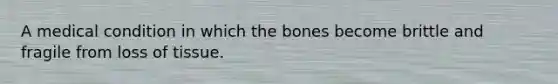 A medical condition in which the bones become brittle and fragile from loss of tissue.