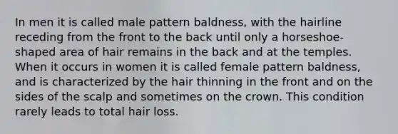 In men it is called male pattern baldness, with the hairline receding from the front to the back until only a horseshoe-shaped area of hair remains in the back and at the temples. When it occurs in women it is called female pattern baldness, and is characterized by the hair thinning in the front and on the sides of the scalp and sometimes on the crown. This condition rarely leads to total hair loss.