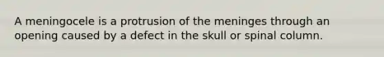 A meningocele is a protrusion of <a href='https://www.questionai.com/knowledge/k36SqhoPCV-the-meninges' class='anchor-knowledge'>the meninges</a> through an opening caused by a defect in the skull or spinal column.