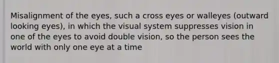 Misalignment of the eyes, such a cross eyes or walleyes (outward looking eyes), in which the visual system suppresses vision in one of the eyes to avoid double vision, so the person sees the world with only one eye at a time